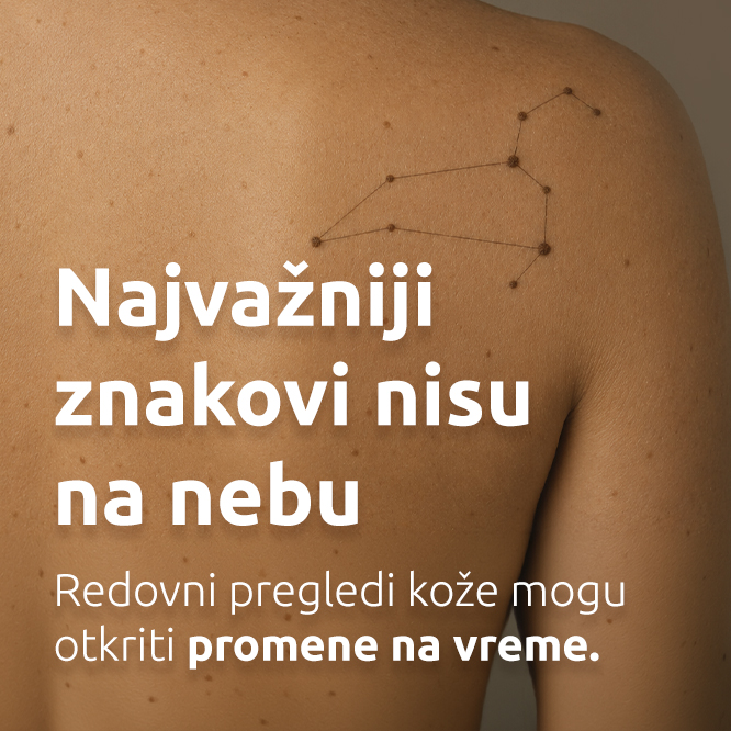 Mesec borbe protiv melanoma - redovni pregledi kože | MediGroup