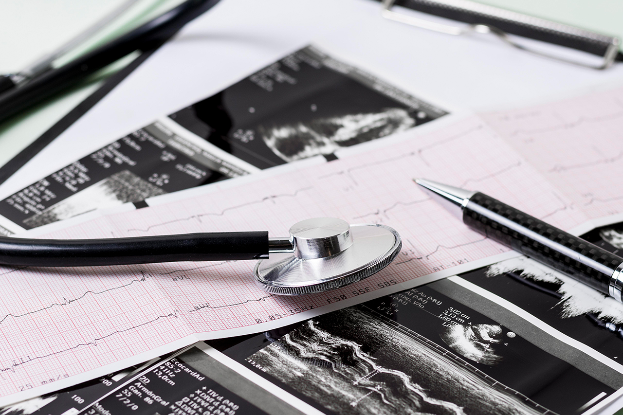 Poliklinika MediGroup Smederevo uvodi naprednu ehokardiografsku dijagnostiku